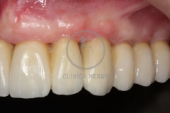 RehabilitacioMaxSuperior10