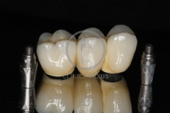 RehabilitacioMaxSuperior5