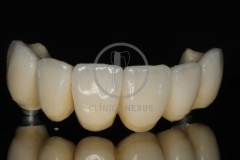 RehabilitacioMaxSuperior6