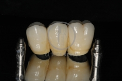 RehabilitacioMaxSuperior7