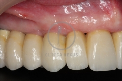 RehabilitacioMaxSuperior8