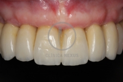 RehabilitacioMaxSuperior9
