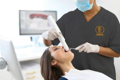 Escaner_intraoral_gabinete