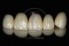 junio_20-5