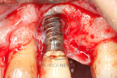 mar_21-6