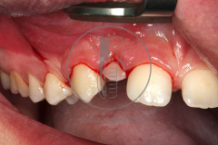 nov_20-3
